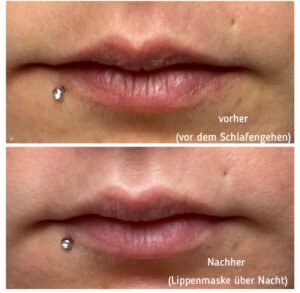 Younique you ology Lippenmaske nach der Anwendung