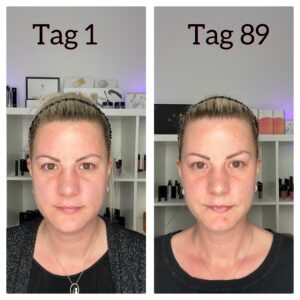 Younique Daily you Kollagenshot 90 Tage Poren