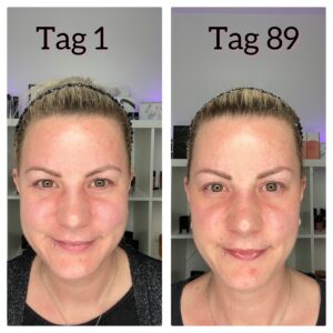 Younique Daily you Kollagenshot 90 Tage Falten